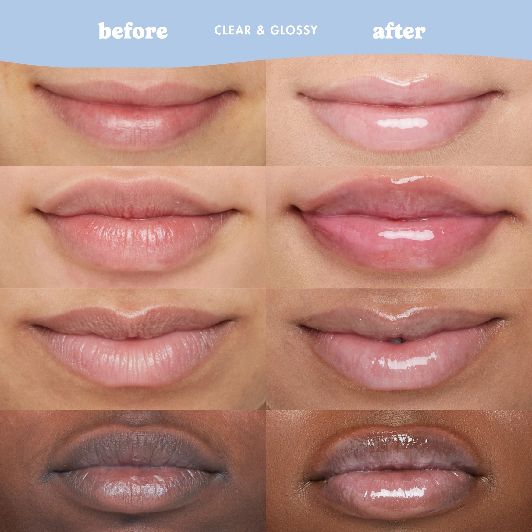 Six close-up lip before-and-after comparison panels showing a clear, glossy lip product on different skin tones. The top has a light blue banner with the text 'before', 'CLEAR & GLOSSY', and 'after'.
